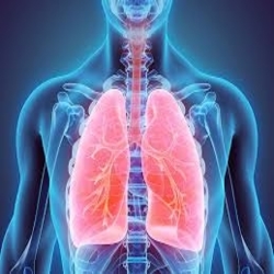 Ce qu'il faut savoir sur le cancer du poumon de stade 3
